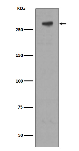 M6PR/IGF2R Rabbit mAb