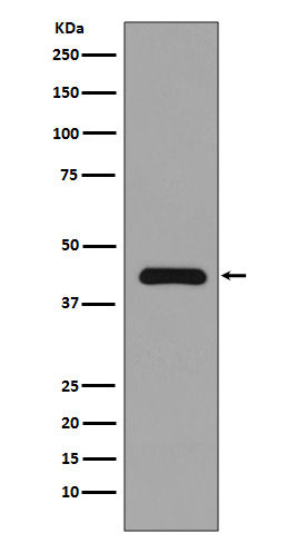 MEK1  Rabbit mAb