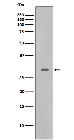 CDK5   Rabbit mAb