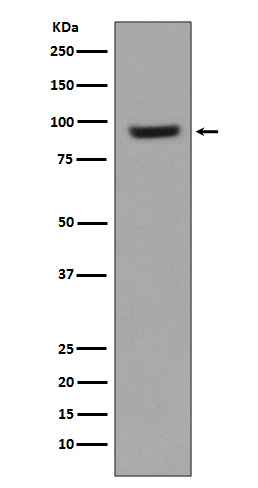ICAM1  Rabbit mAb