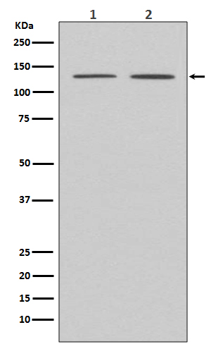 APAF1  Rabbit mAb