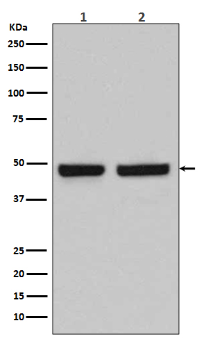 HAPLN1  Rabbit mAb