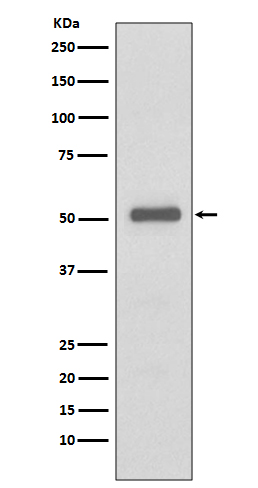 p57 Kip2  Rabbit mAb