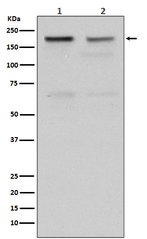 Topoisomerase II alpha Rabbit mAb