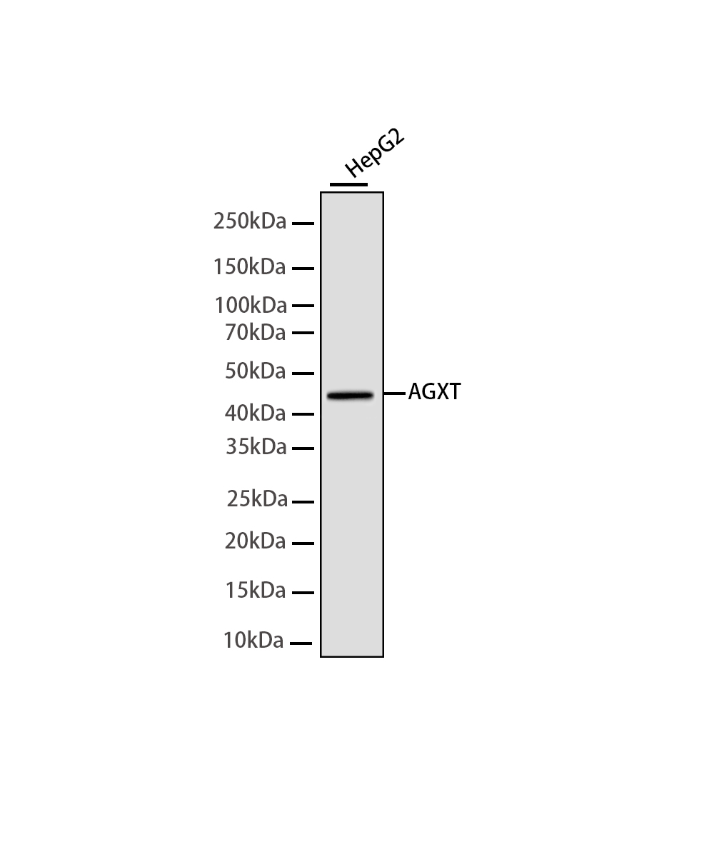 AGXT Rabbit mAb