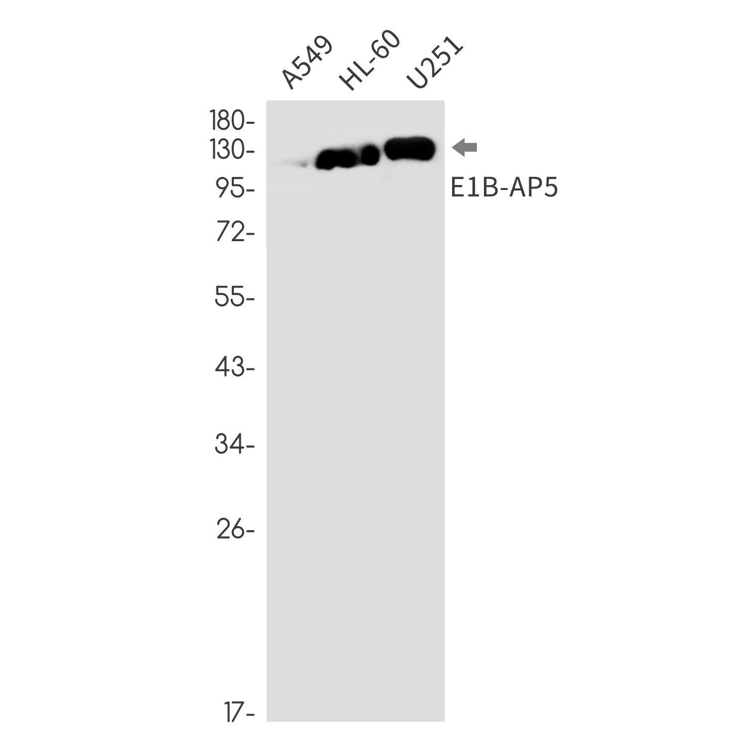HNRNPUL1 Rabbit mAb