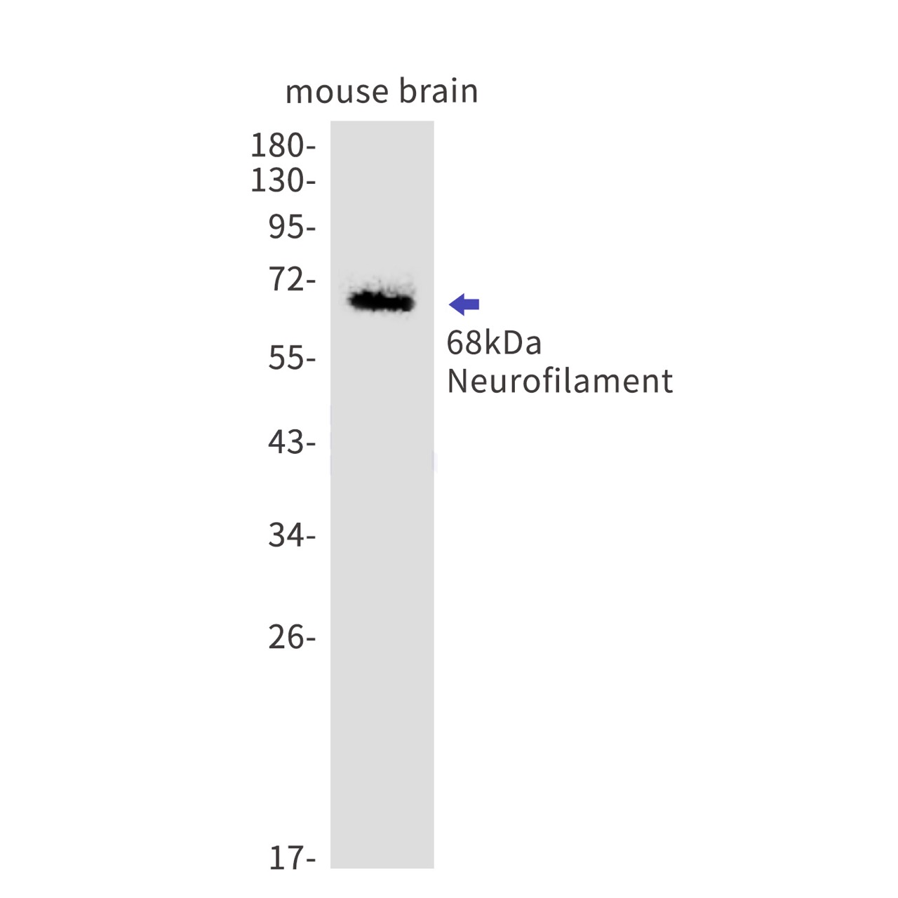 68kDa Neurofilament Rabbit mAb
