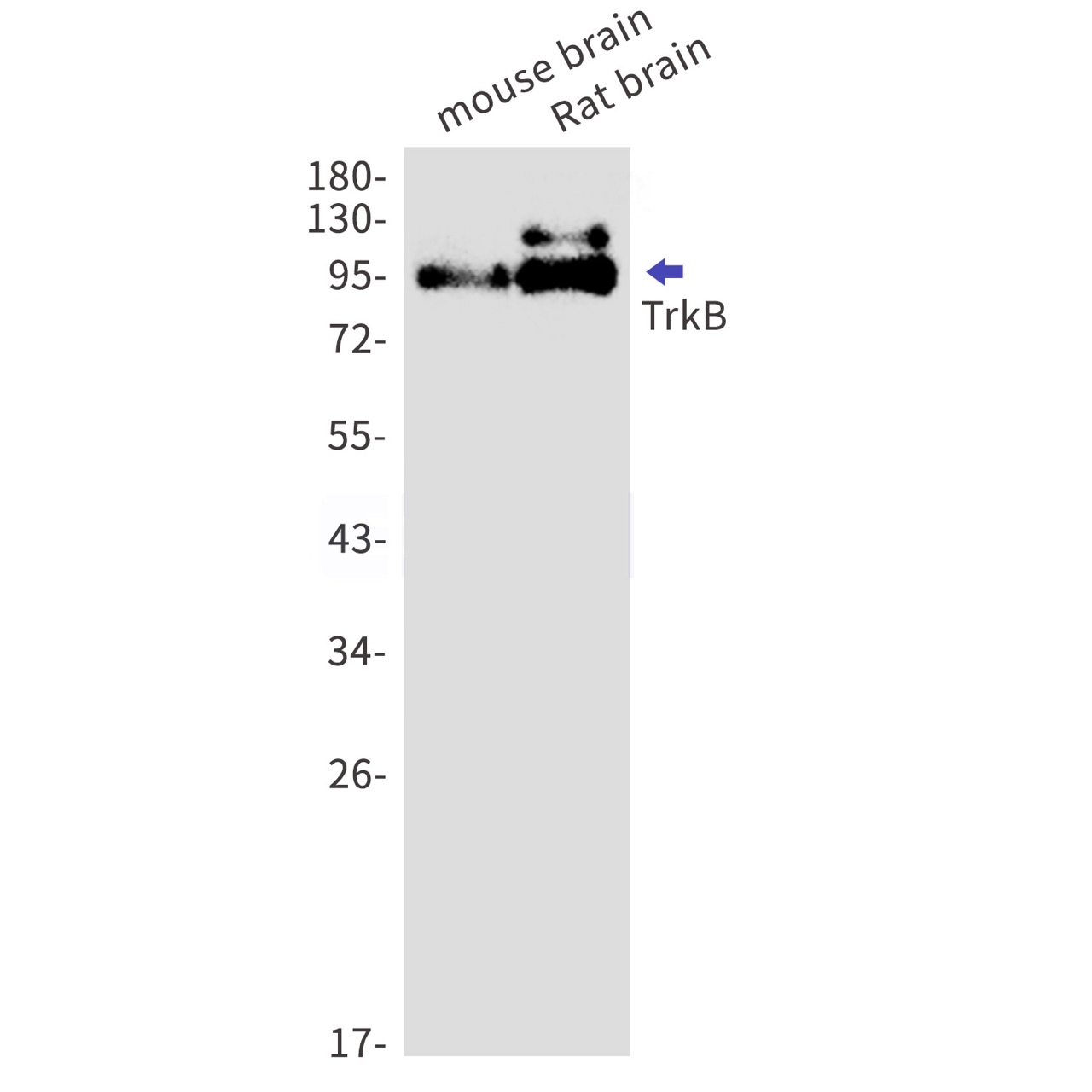 TrkB Rabbit mAb