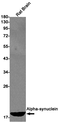 Alpha-synuclein Rabbit mAb