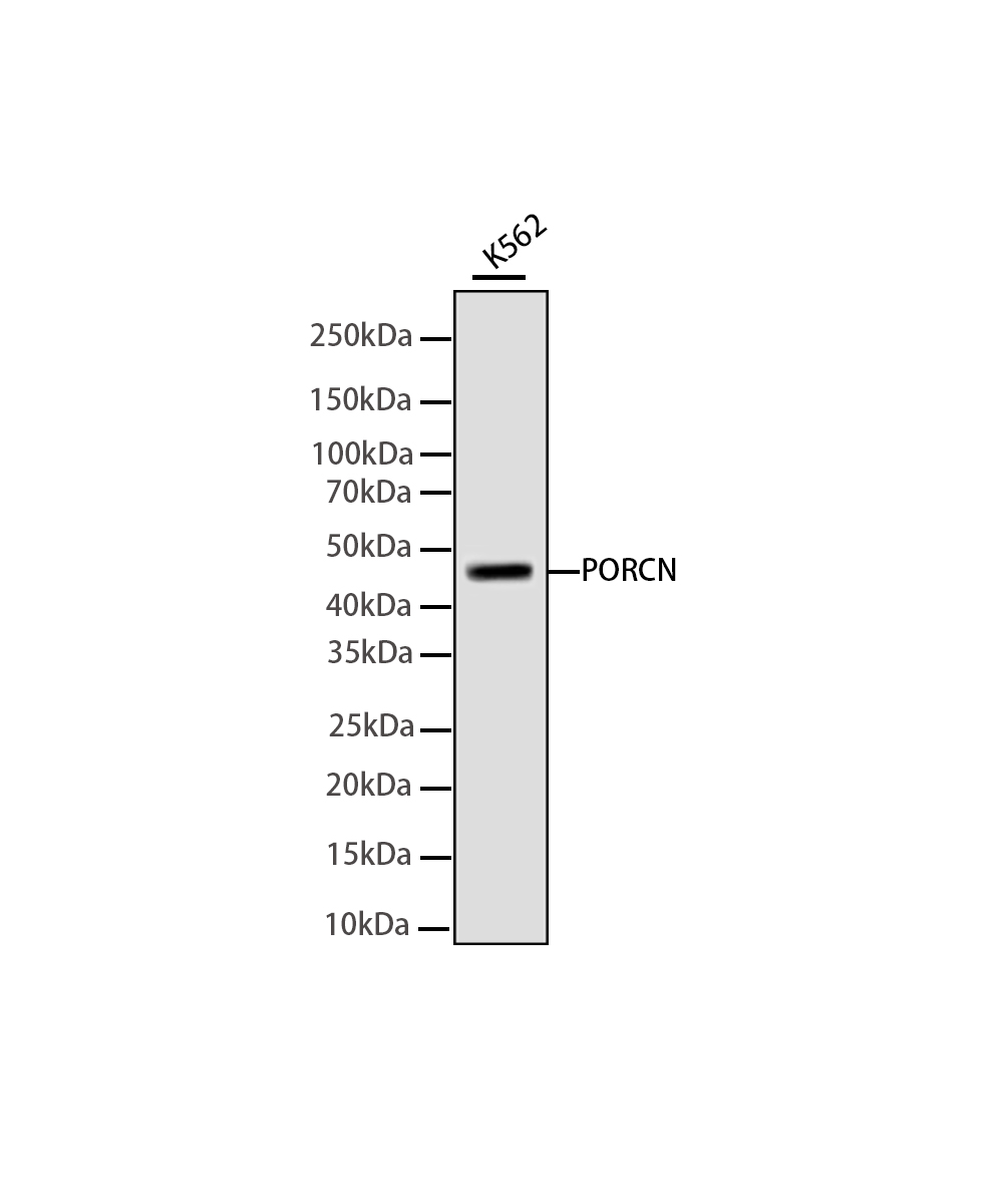 PORCN Rabbit mAb