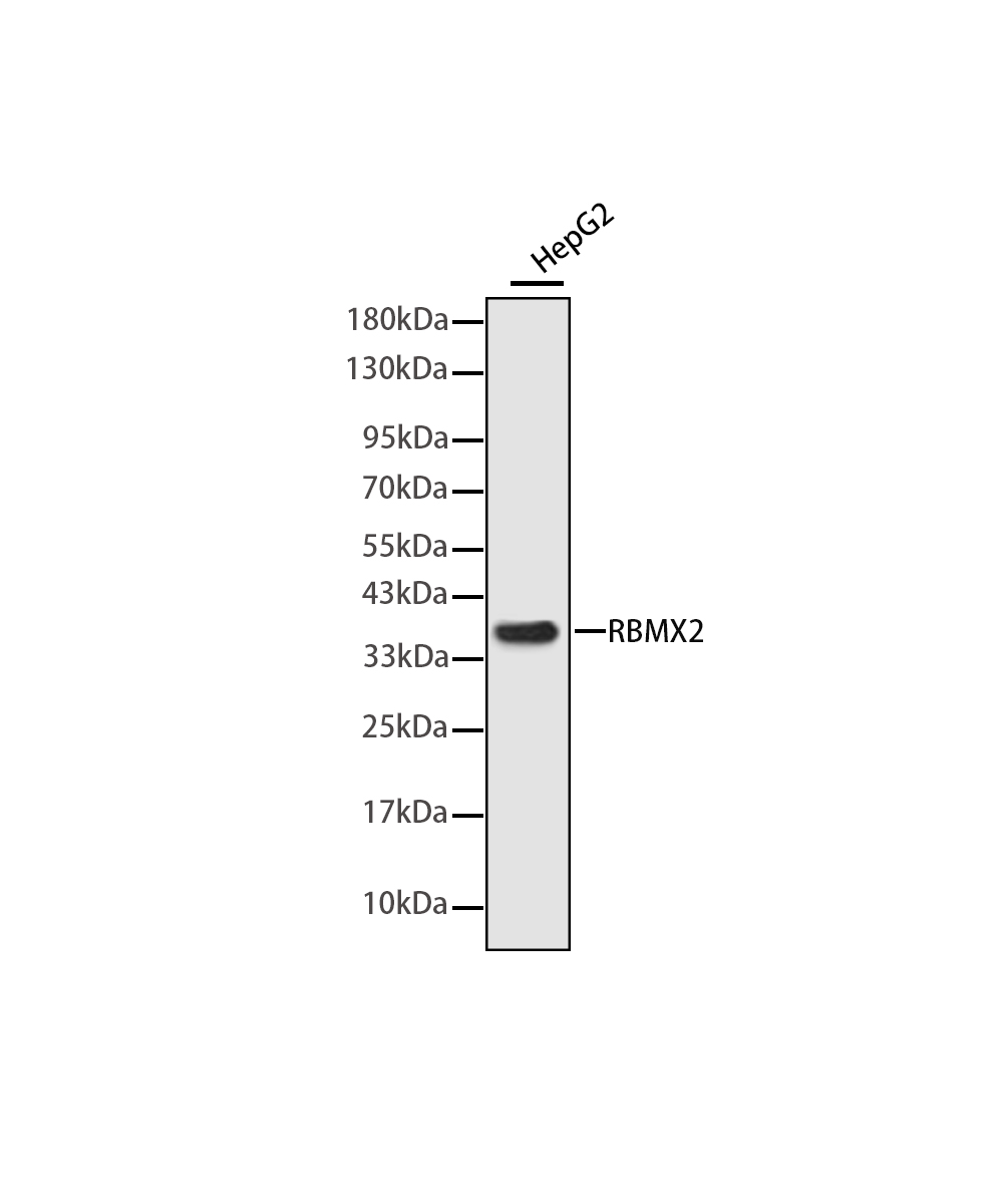 RBMX2 Rabbit mAb