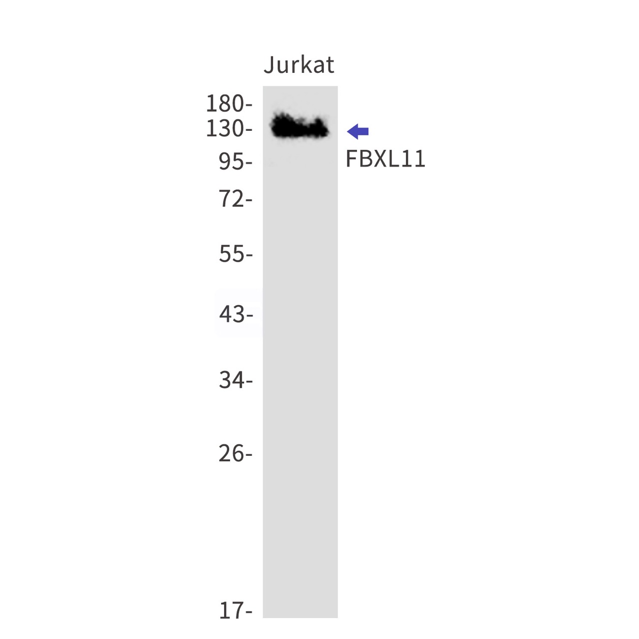 FBXL11 Rabbit mAb