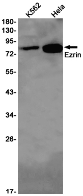Ezrin Rabbit mAb