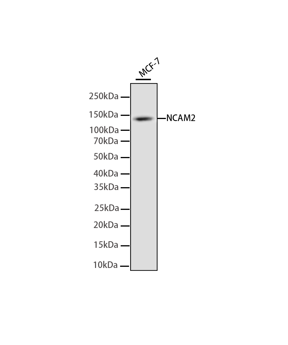 NCAM2 Rabbit mAb