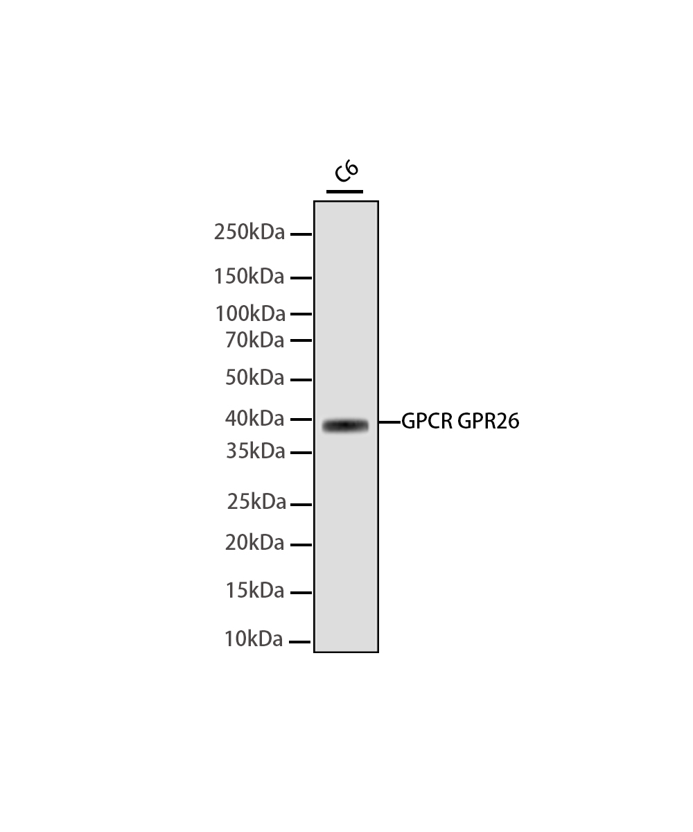 GPCR GPR26 Rabbit mAb