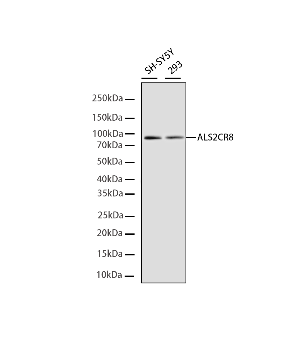 ALS2CR8 Rabbit mAb