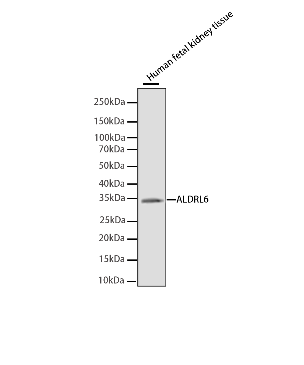 MIOX Rabbit mAb