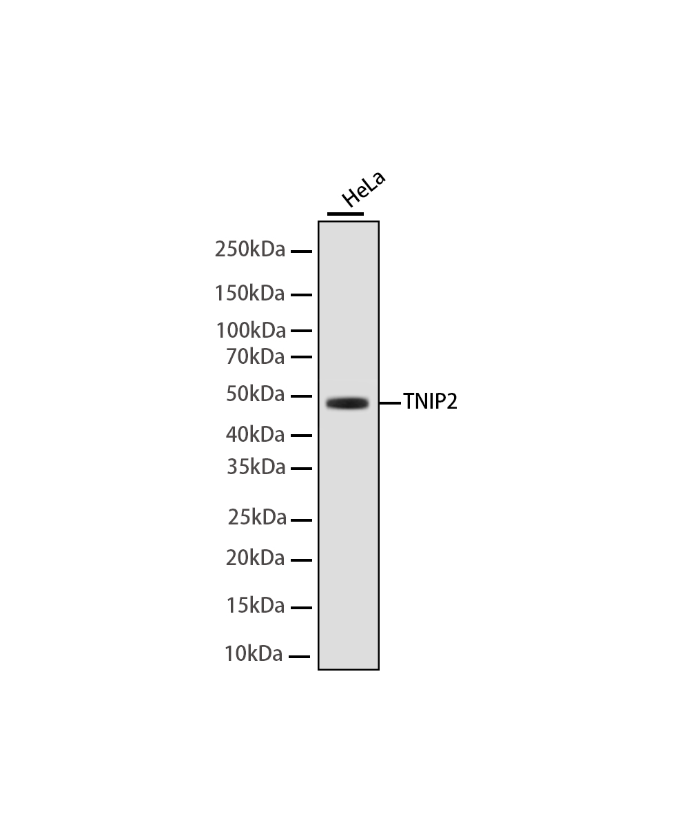TNIP2 Rabbit mAb