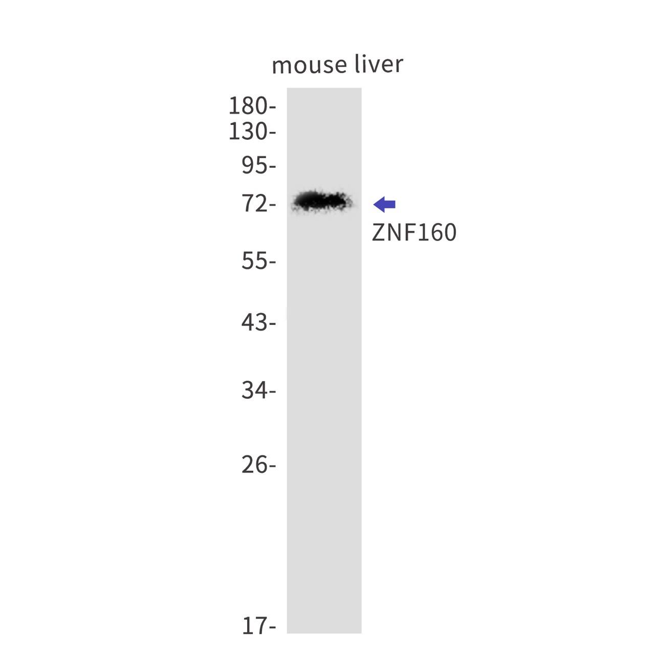 ZNF160 Rabbit mAb