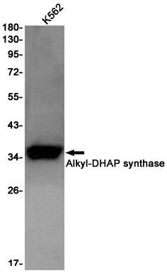 Alkyl-DHAP synthase Rabbit mAb