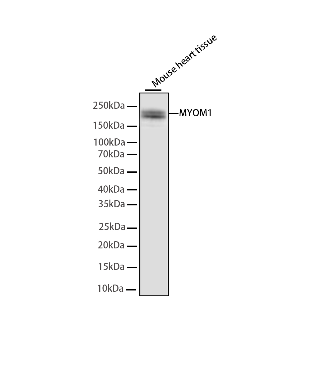 MYOM1 Rabbit mAb
