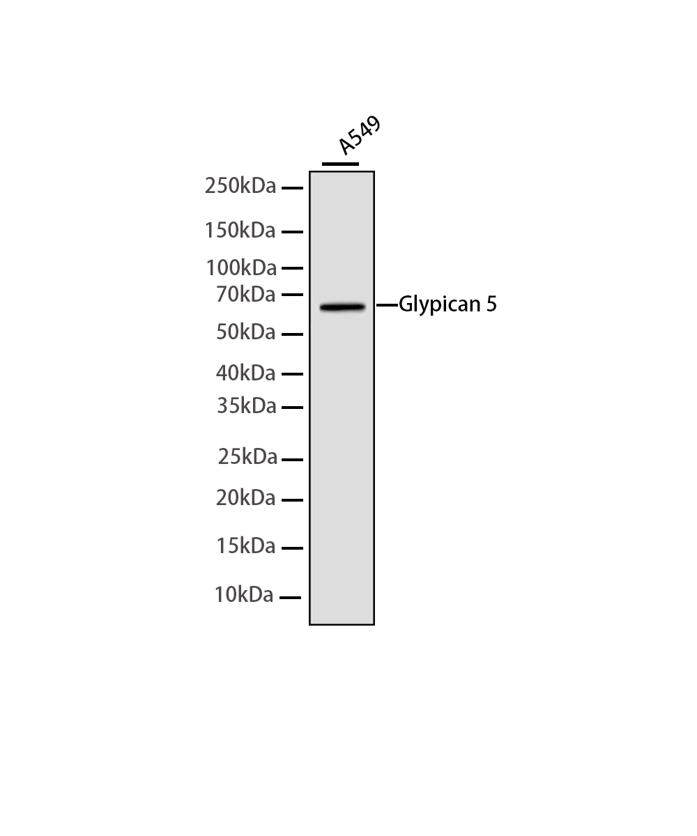 Glypican 5 Rabbit mAb