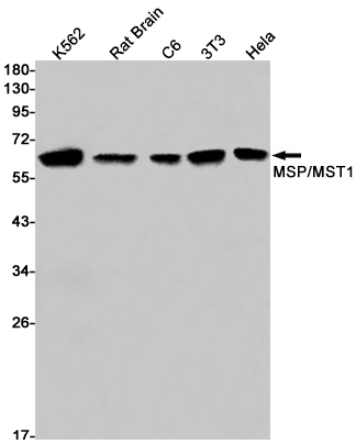 Serine/threonine-protein kinase 4 Rabbit mAb