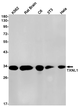 TXNL1 Rabbit mAb