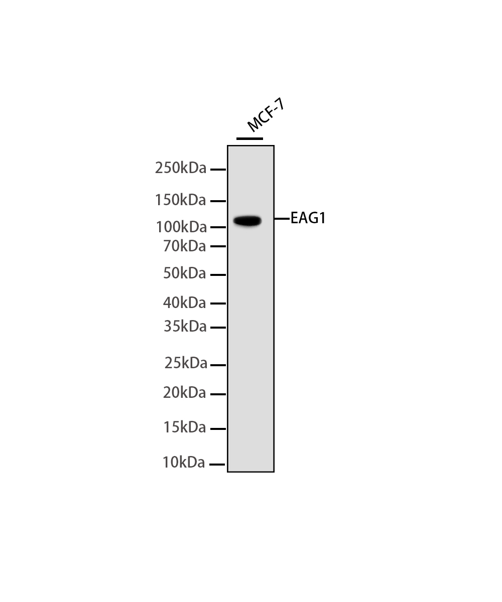 EAG1 Rabbit mAb