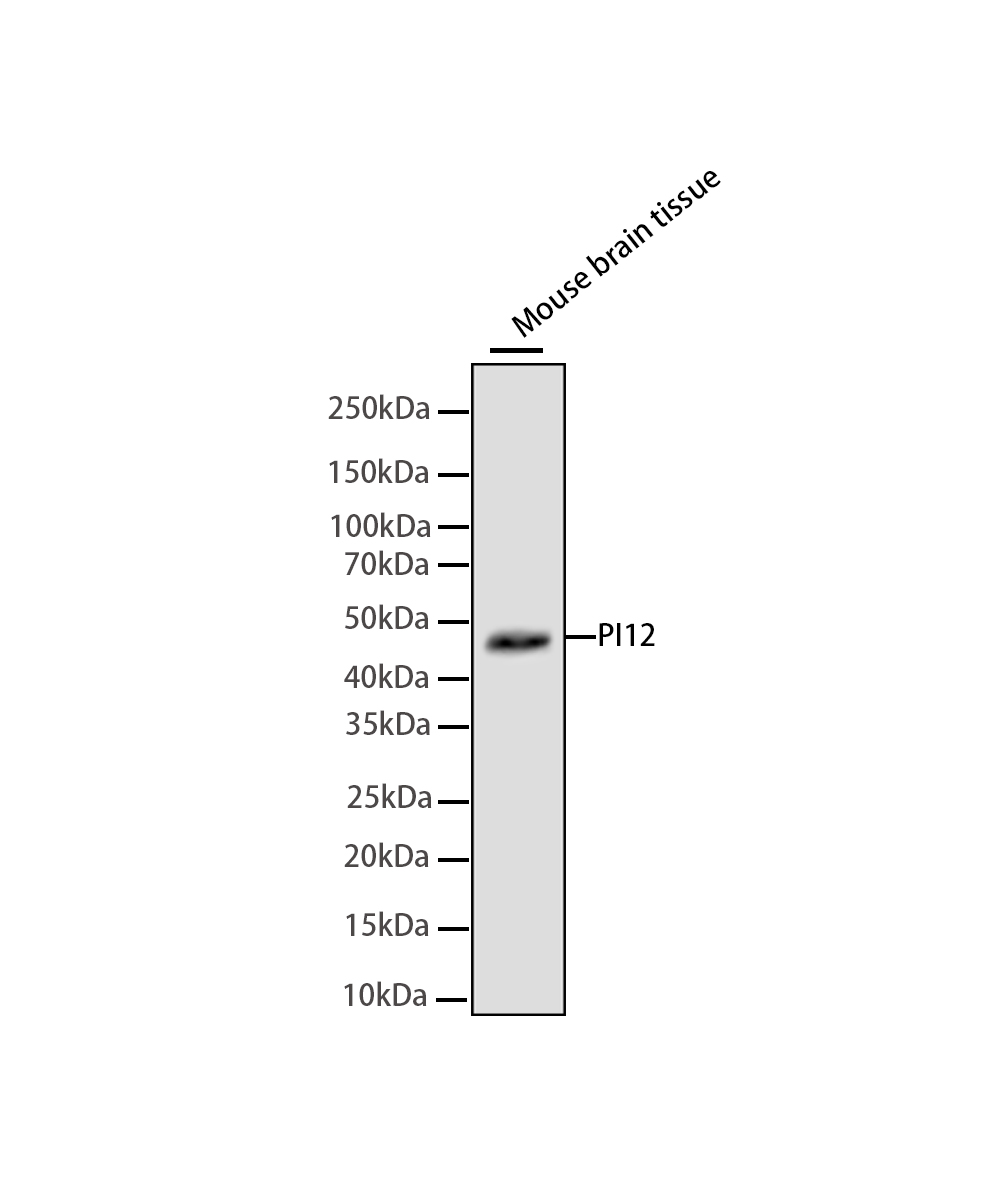 Neuroserpin Rabbit mAb