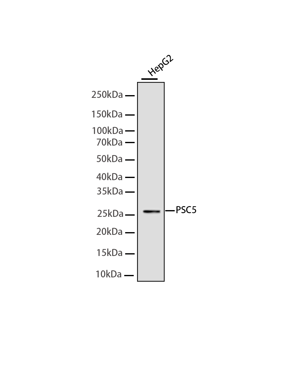 Proteasome 20S alpha 5/PSMA5 Rabbit mAb