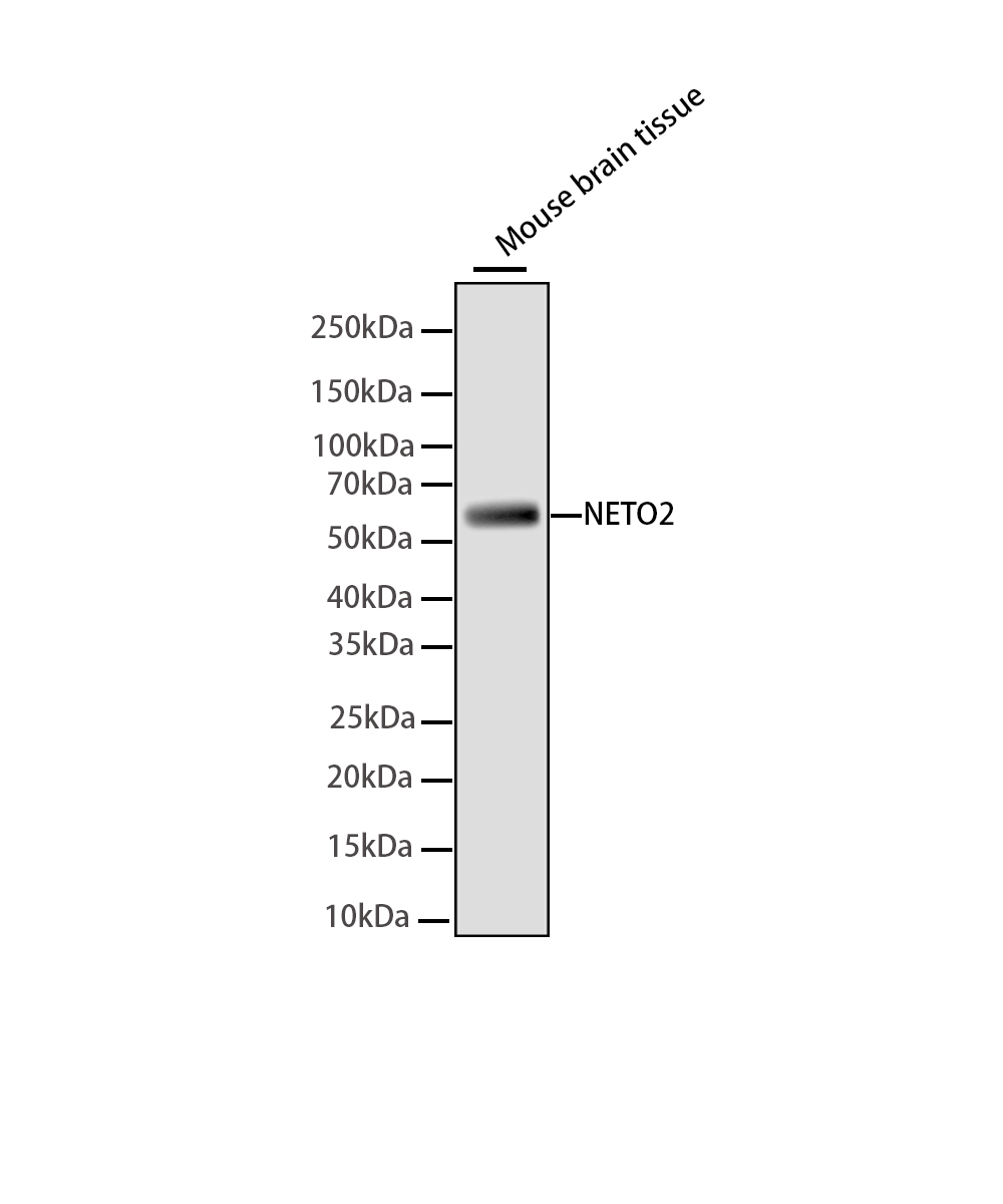NETO2 Rabbit mAb