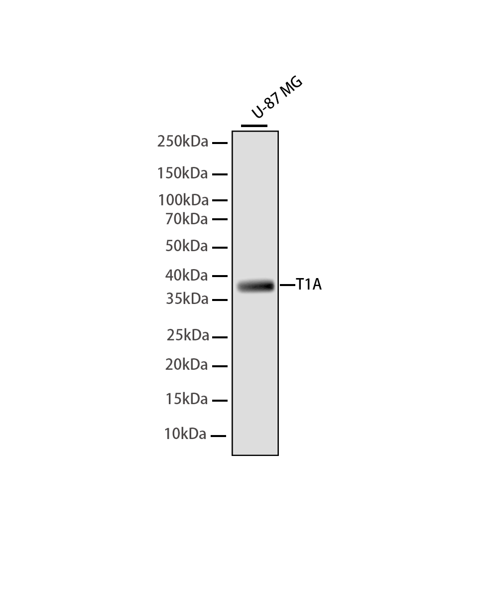 Podoplanin/gp36 Rabbit mAb