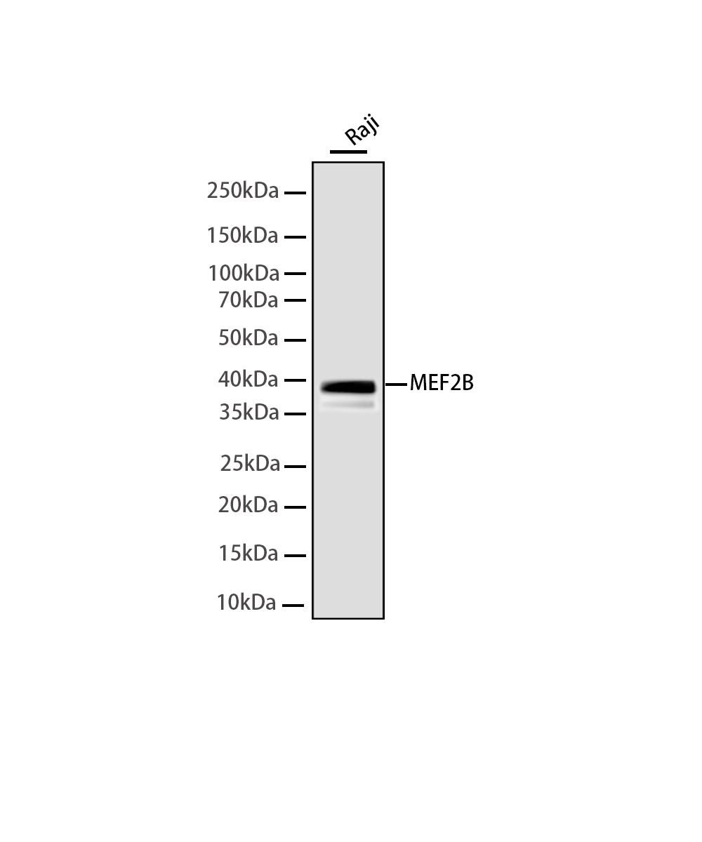 MEF2B Rabbit mAb