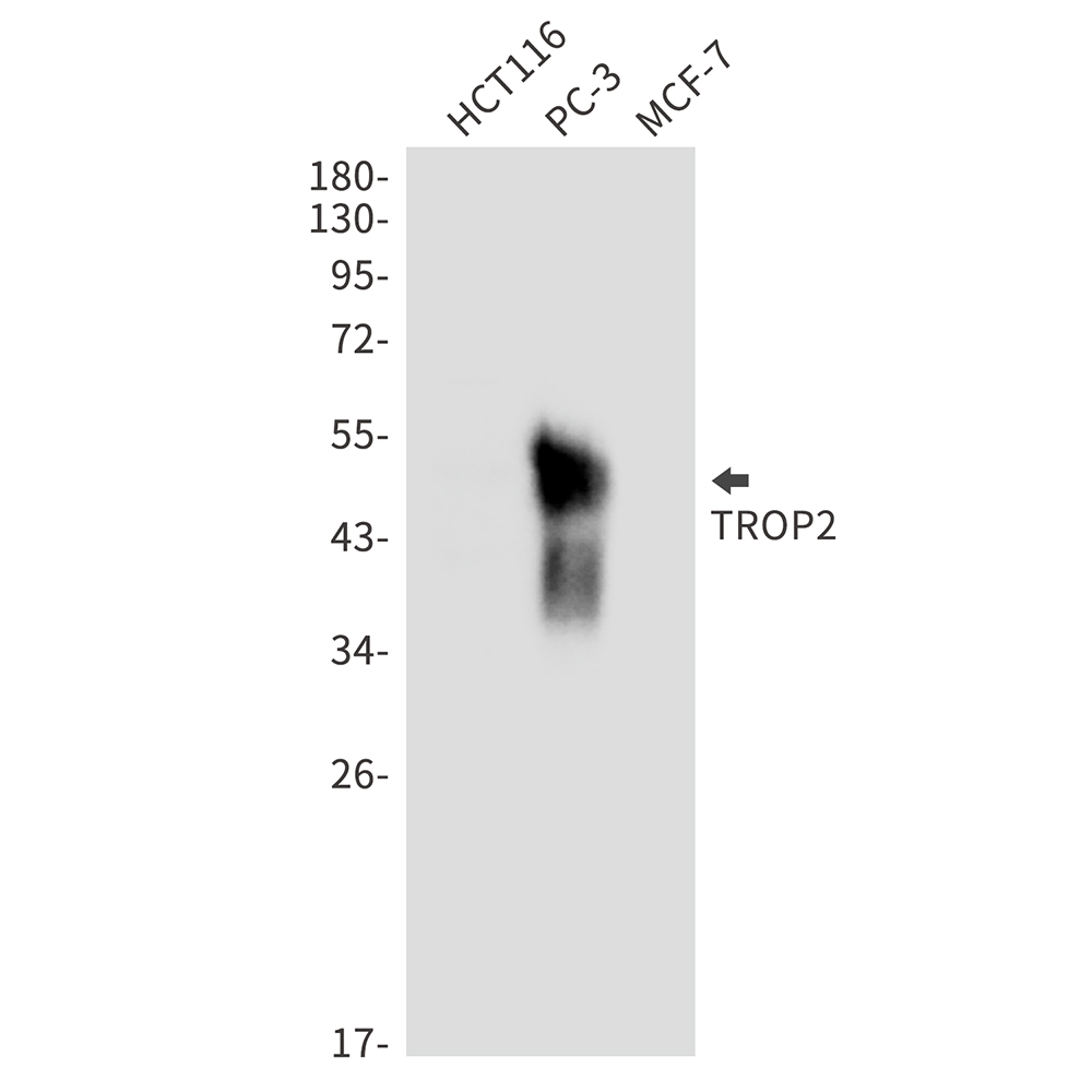 TACD2 Rabbit mAb