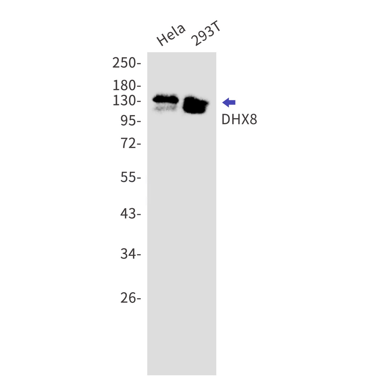 DHX8 Rabbit mAb