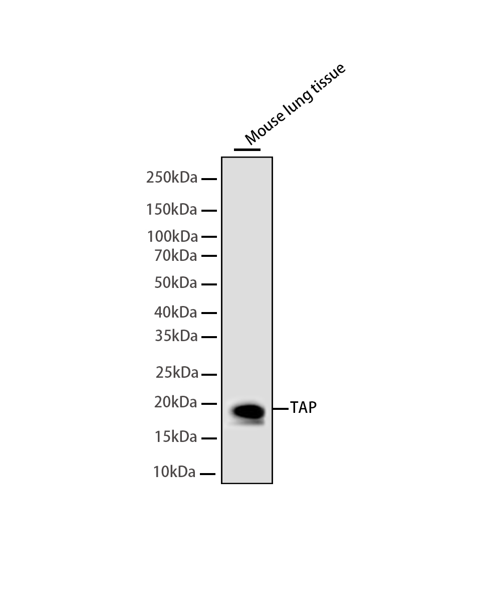 Sca1/Ly6A/E Rabbit mAb