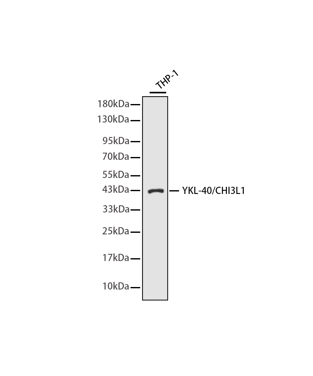 YKL-40/CHI3L1 Rabbit mAb