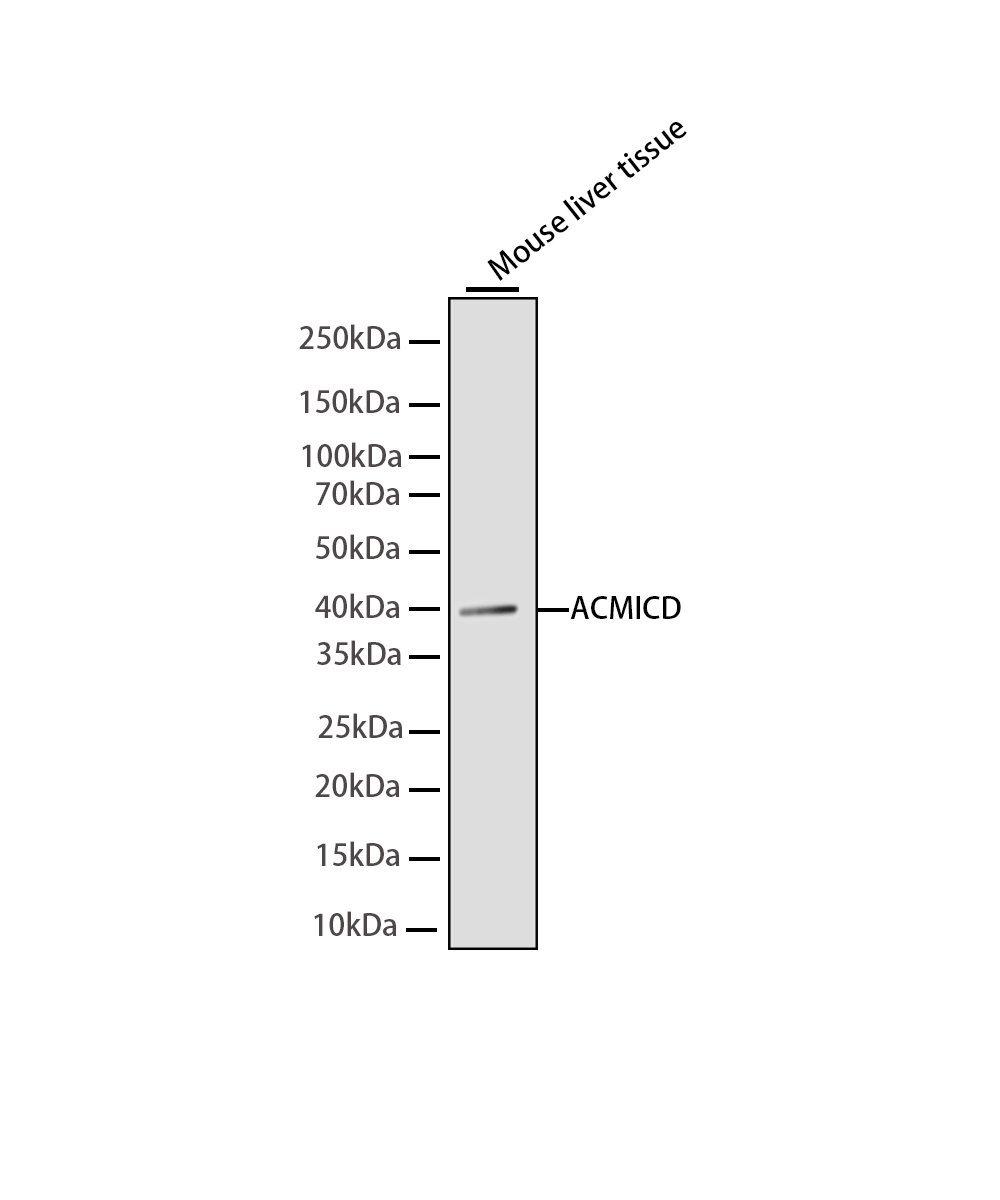 Ornithine Carbamoyltransferase Rabbit mAb