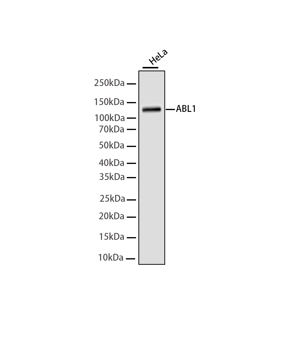 ABL1 Rabbit mAb
