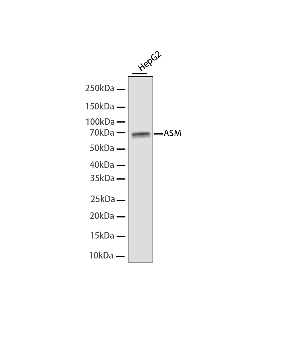 Acid sphingomyelinase Rabbit mAb