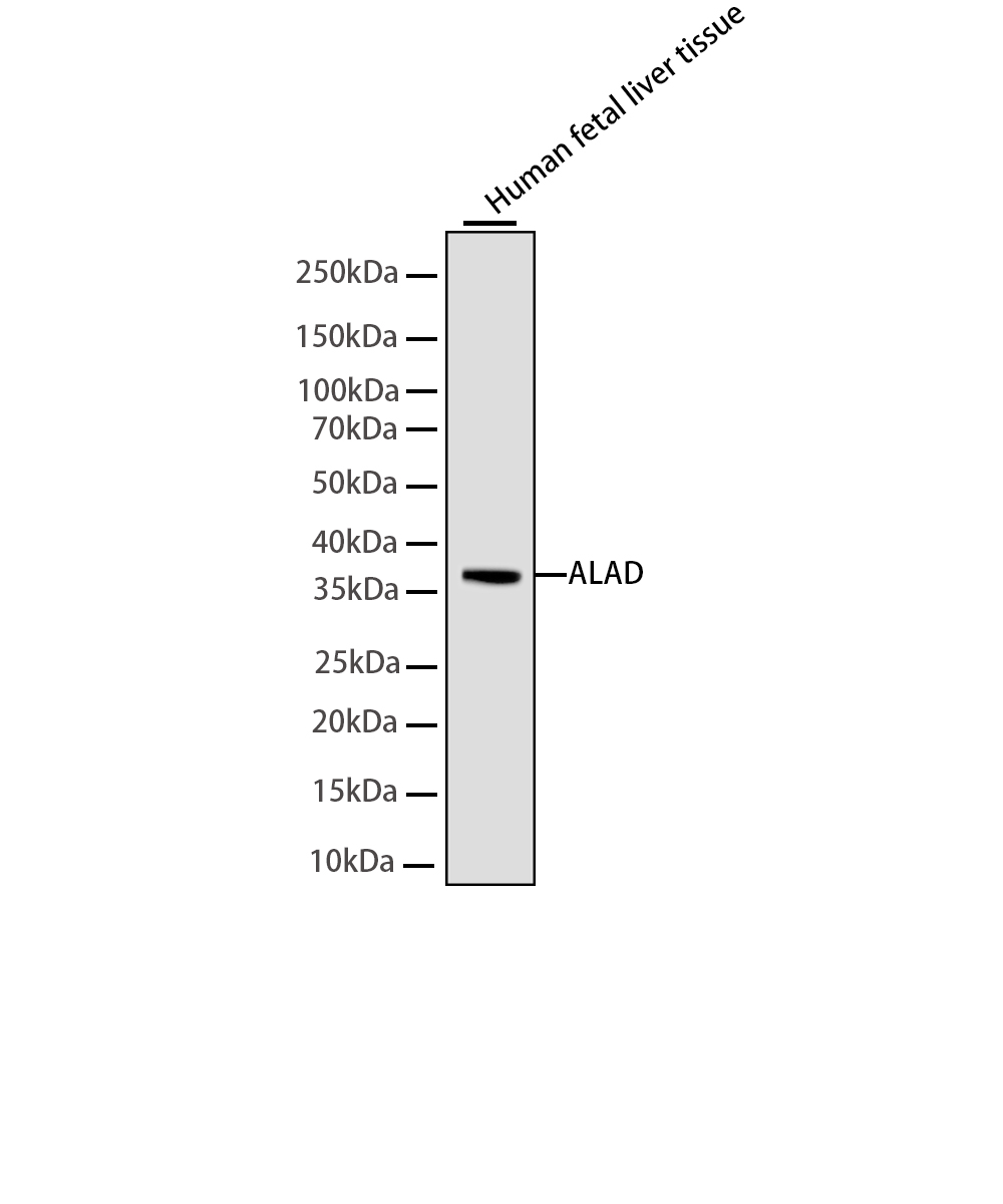 ALAD Rabbit mAb