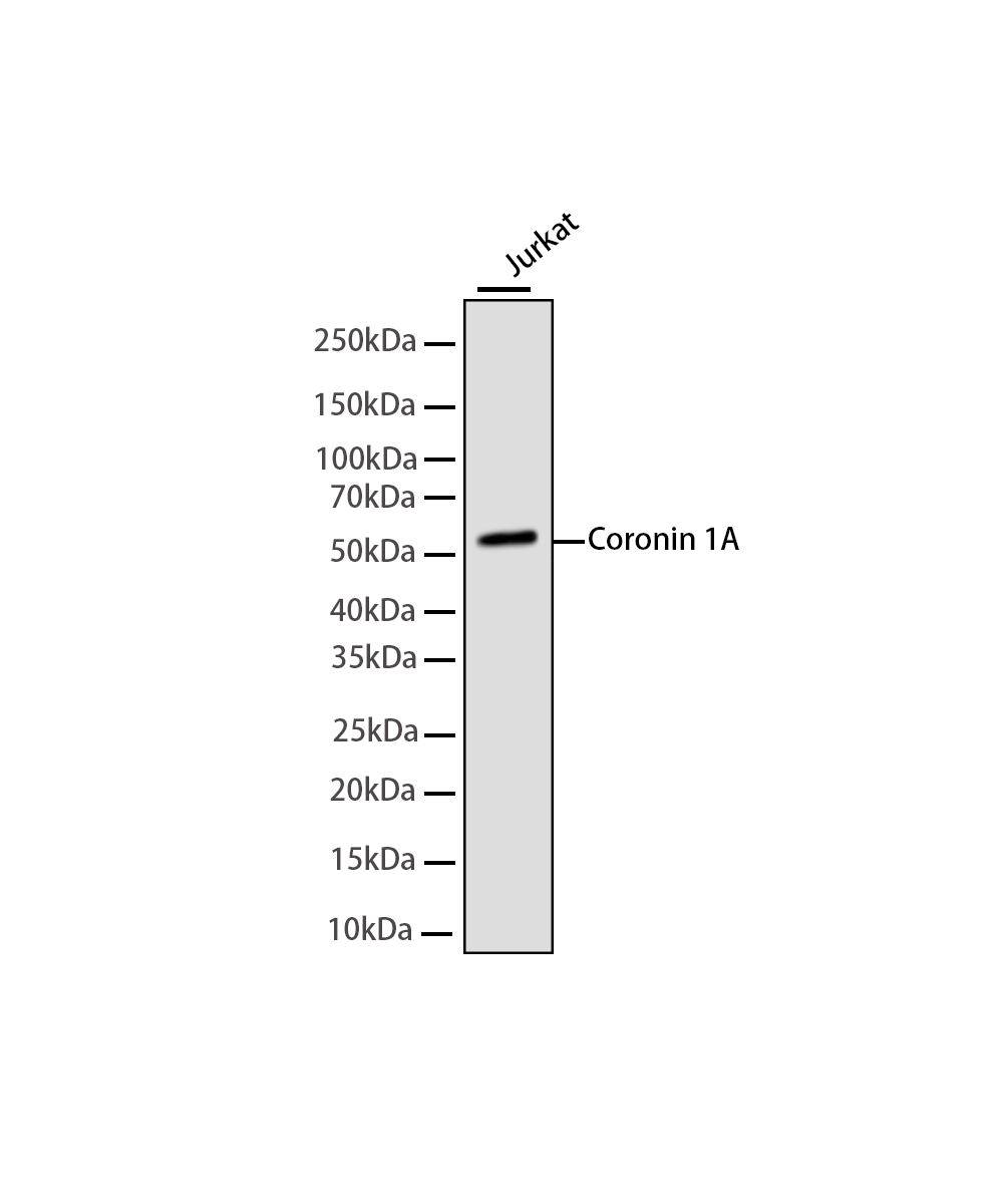 Coronin 1A Rabbit mAb