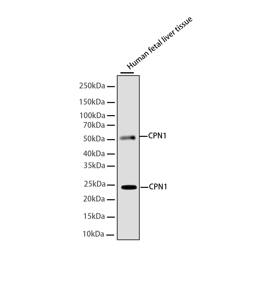CPN1 Rabbit mAb