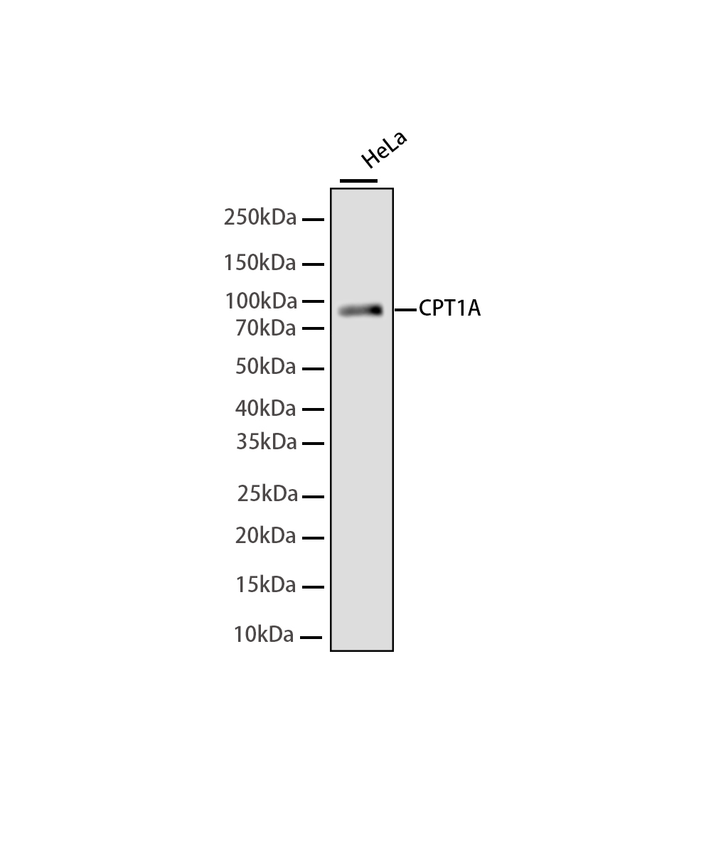 CPT1A Rabbit mAb