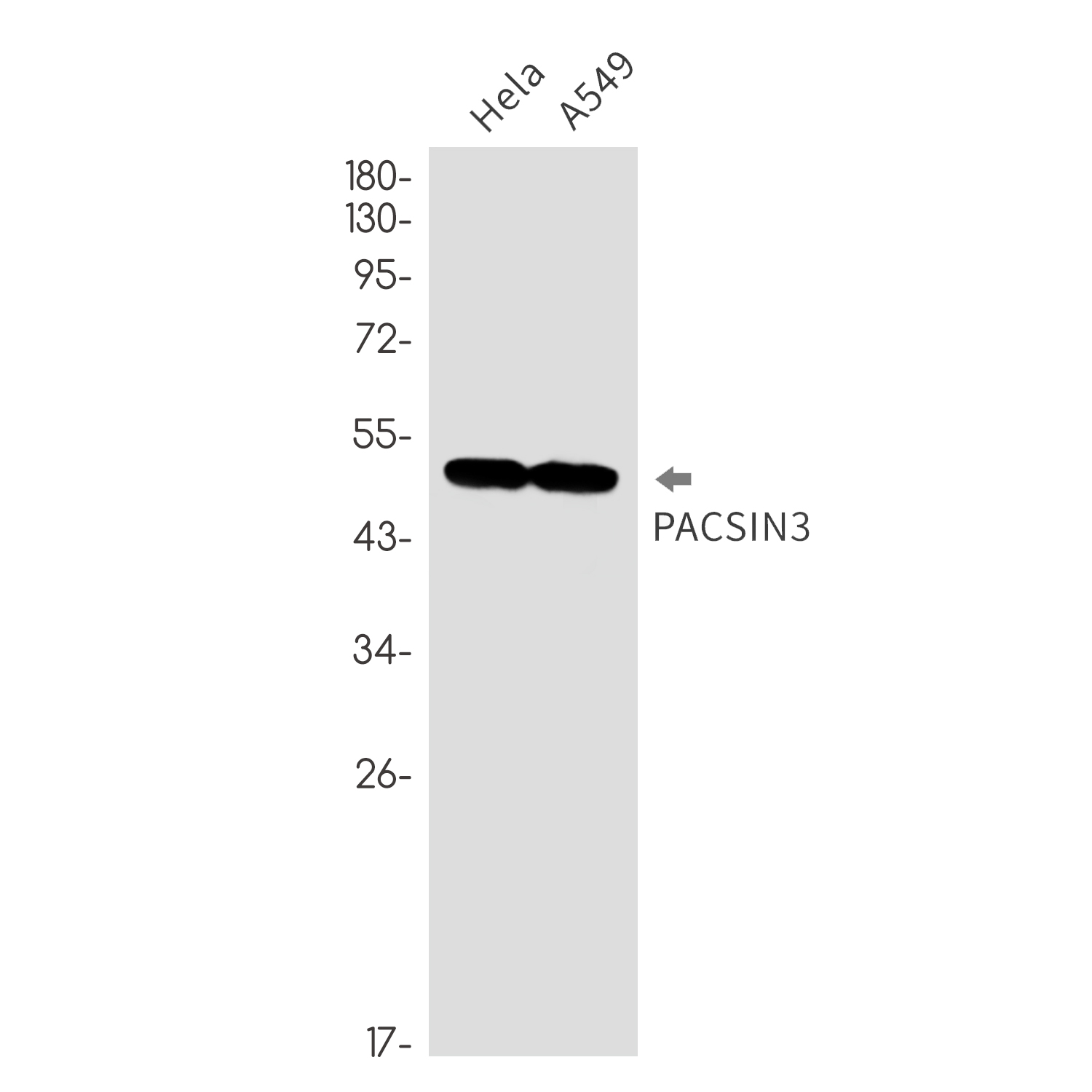 PACSIN3 Rabbit mAb
