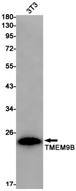 TMEM9B Rabbit mAb