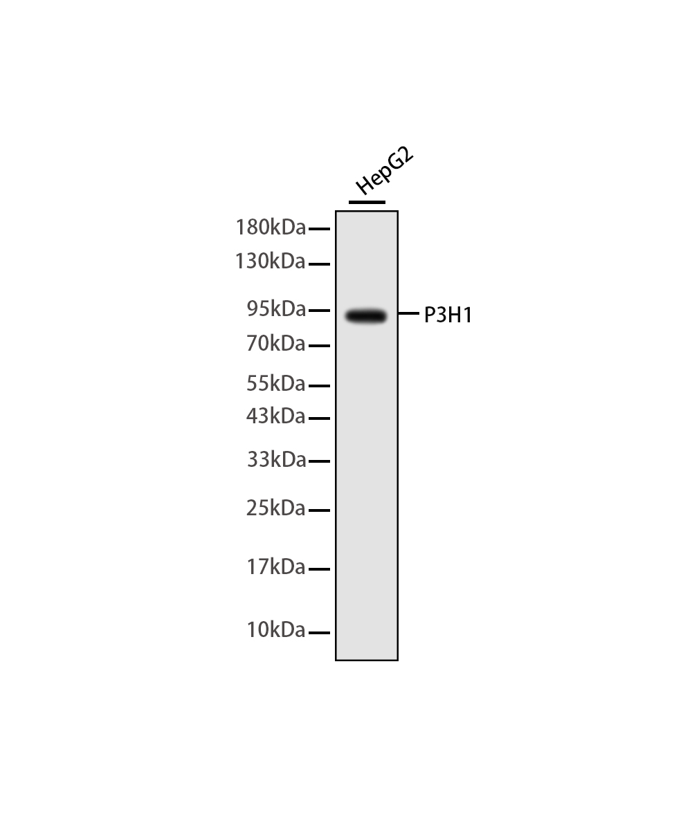 P3H1 Rabbit mAb