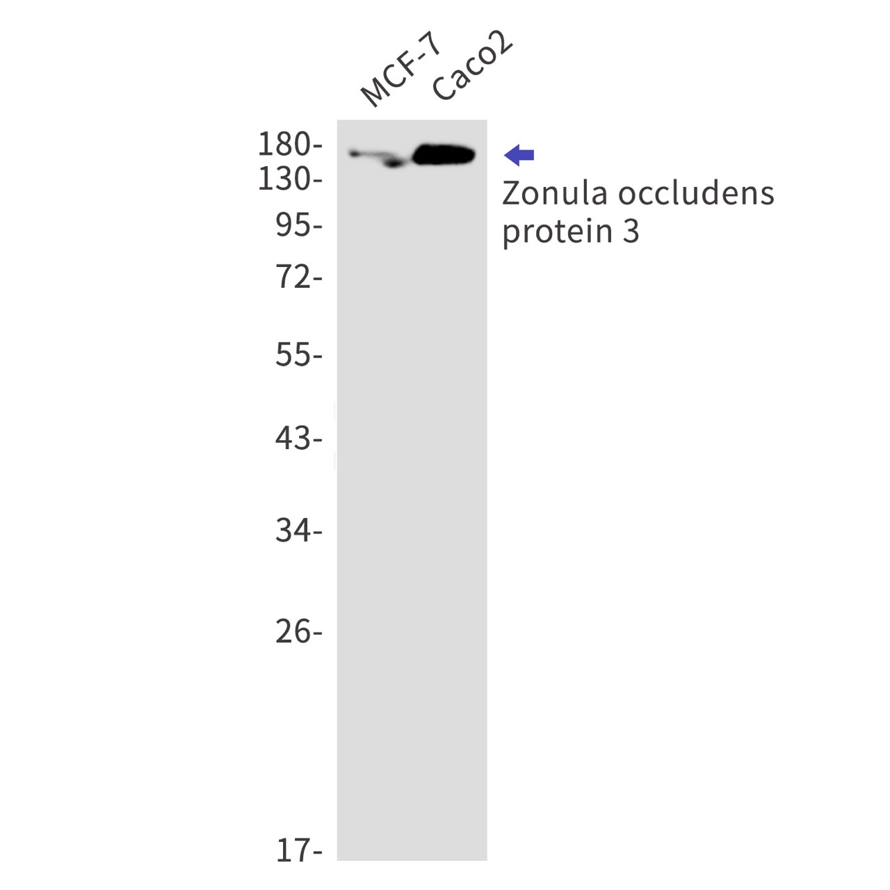 Zonula occludens protein 3 Rabbit mAb
