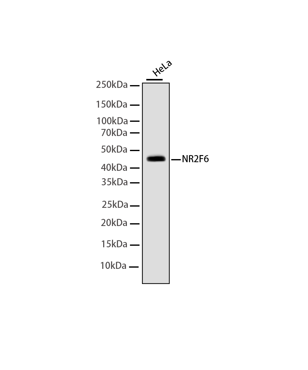 NR2F6 Rabbit mAb
